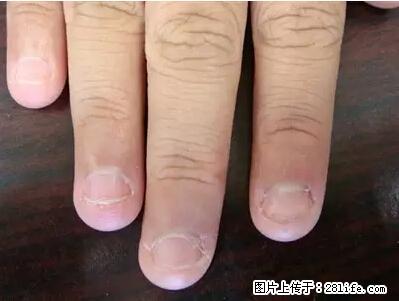 剪指甲、挖耳屎，这些日常小动作竟隐藏大危害！ - 鄂尔多斯生活资讯 - 鄂尔多斯28生活网 erds.28life.net